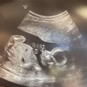 Meet your Posher, Ochoa